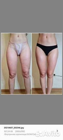 Массаж аппаратный антицеллюлитный коррекция фигуры