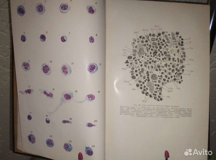 Клиническая гематология. Госмедиздат УССР 1962