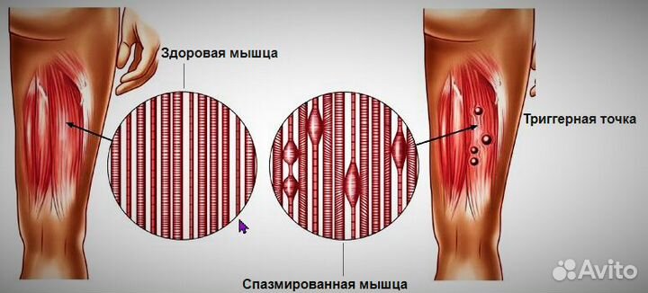 Миопрессура-Юмейхо-Тайский-Йога-Фитооздоровление