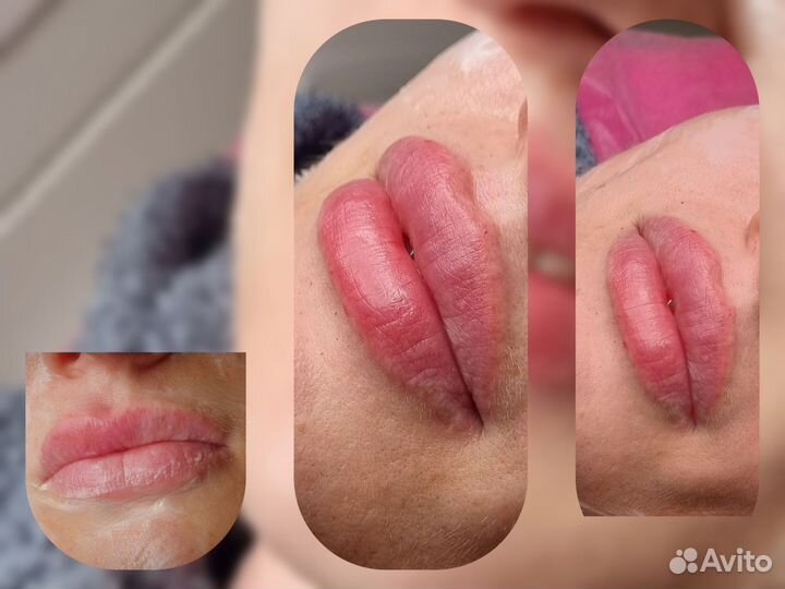 Услуги косметолога