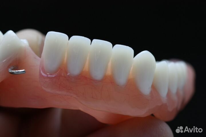 Частичный съемный протез
