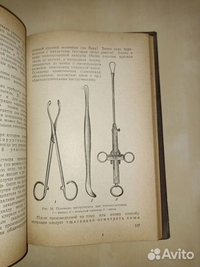 Хронический тонзиллит и его связь с другими заболе