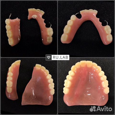 Ремонт протеза своими руками