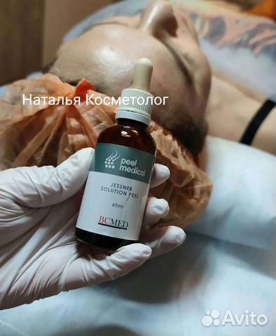 Пилинг Джесснера разлив деление распив