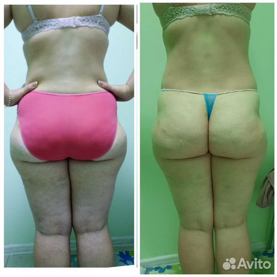 Массаж детям и взрослым / липопластика