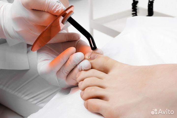 Курсы подологии в Нижнем Новгороде