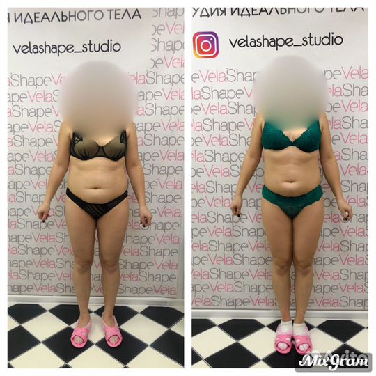 Массаж Похудение Коррекция фигуры Косметолог