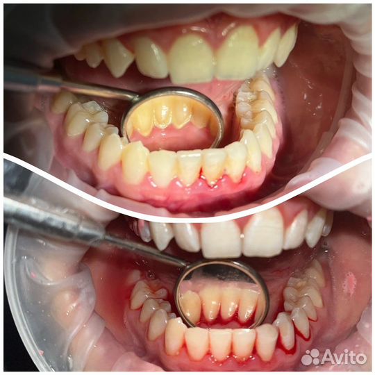 Гигиенист стоматологический