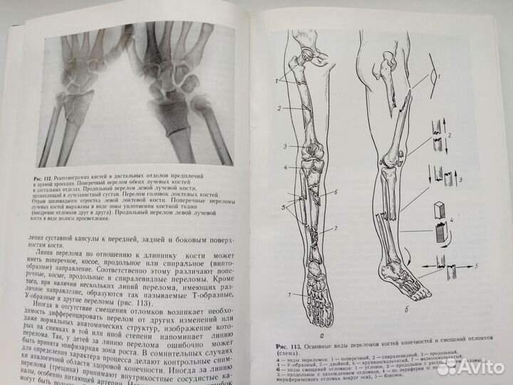 Книга Неотложная рентгенодиагностика Кишковский