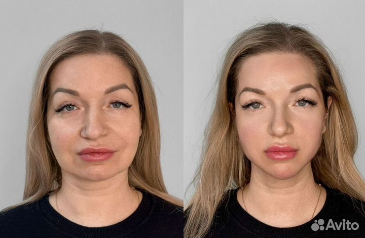 Королевский лифтинг 