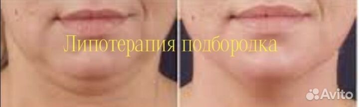 Услуги косметолога