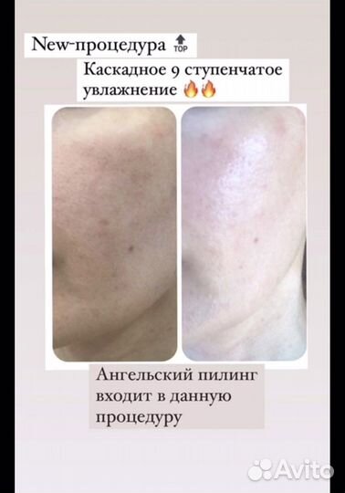Услуги косметолога