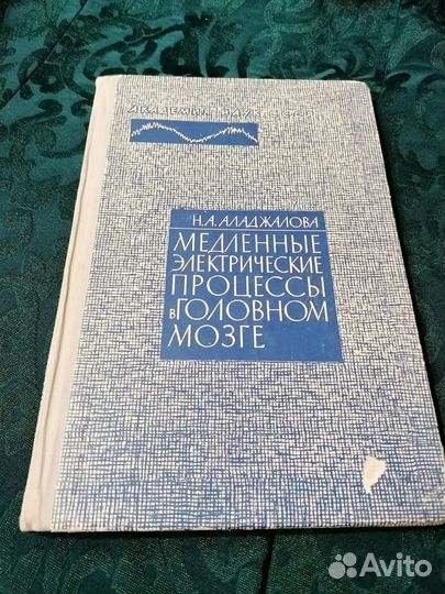 Медленные электрические процессы в головном мозге