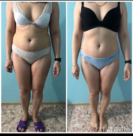 Ищем моделей на подтяжку животика