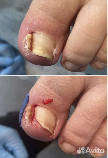 Педикюр/Подология