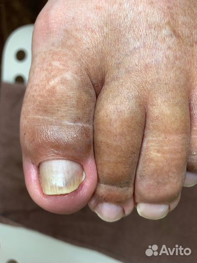 Услуги подолога