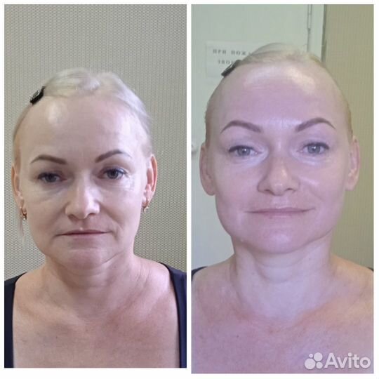 Массаж лица