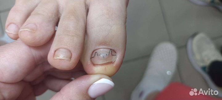 Подолог, сертифицированный мастер педикюра