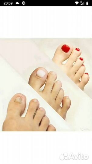 Медицинский педикюр