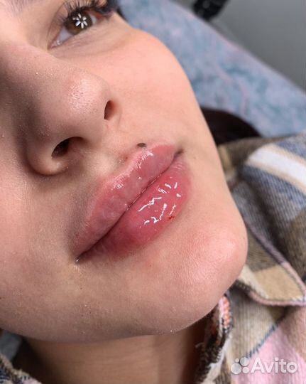 Врач косметолог