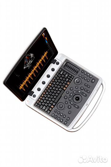 Узи-аппарат Chison SonoBook 9