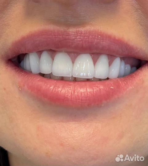 Зубной техник