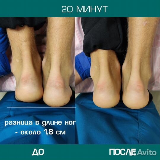 Костоправ. Массаж. Вправление