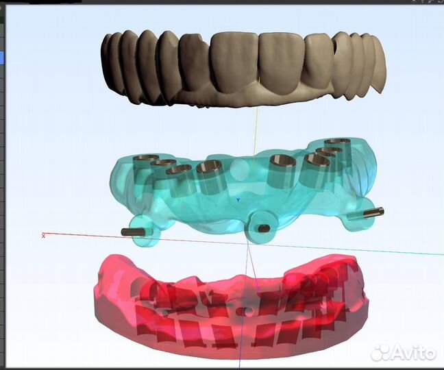 PlastyCad v1.7& 3Diagnosys v4.2 + Обучение