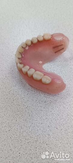 Изготовление и починка съёмных зубных протезов