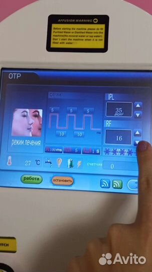 Элос эпиляция