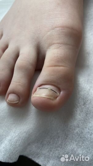 Подологические услуги