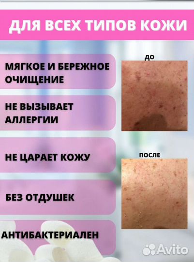 Скраб- варежка пилинг