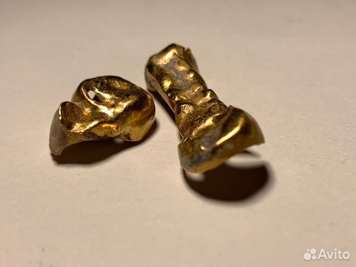 Золотые коронки