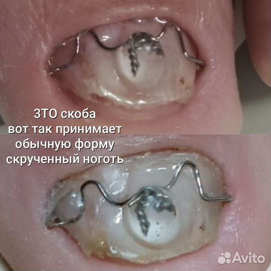 Подолог. Мастер-педикюра