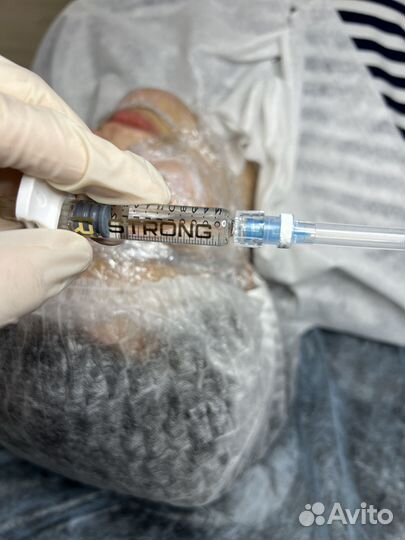 Увеличение губ