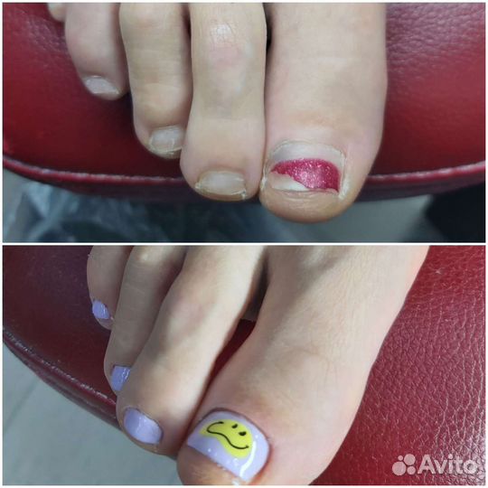 Смарт педикюр