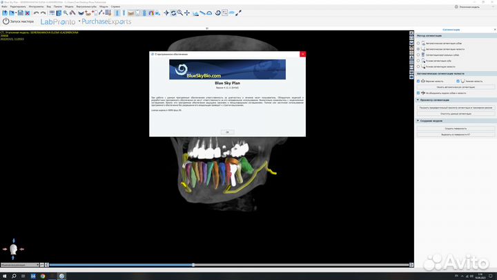 Exocad 3.1RijekaExoplan3.13Shape 2023RealGuide 5.3
