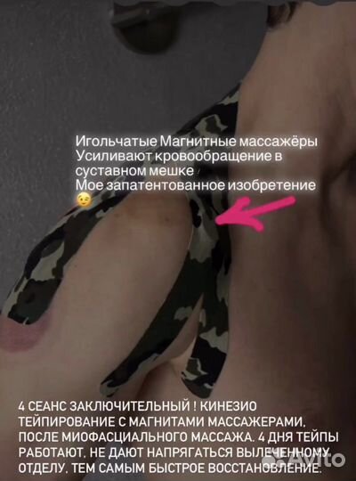 Массаж при острых болях и защемлении нерва