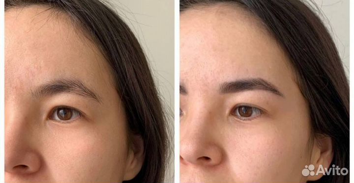 Брови и ресницы Ботаника