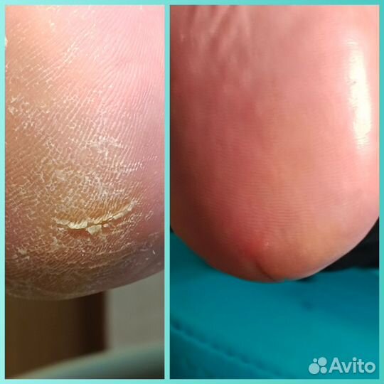 Наращивание ногтей/ маникюр/педикюр