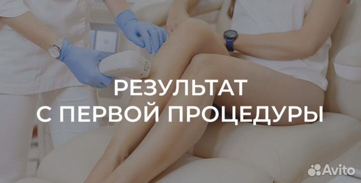 Лазерная эпиляция