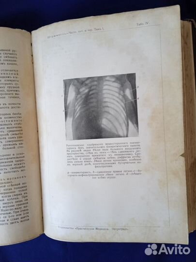 Учебник патологии и терапии 1915г. А. Штрюмпель