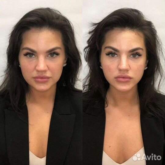 Консультация косметолога