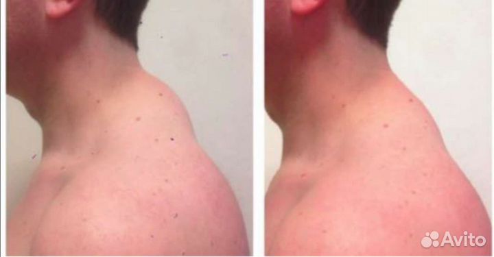 Проф. Массаж