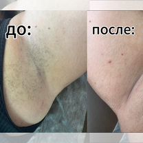Шугаринг/ваксинг, Энгельс