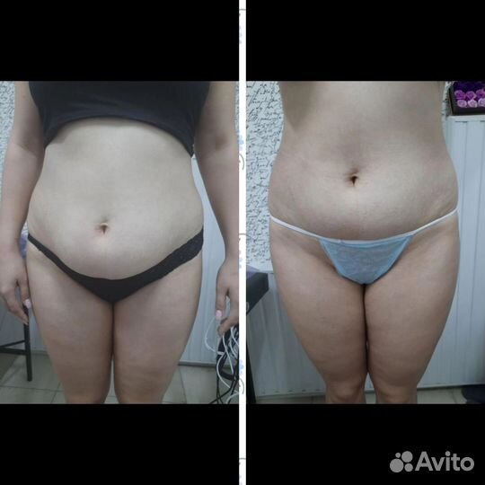 Оздоровительный массаж