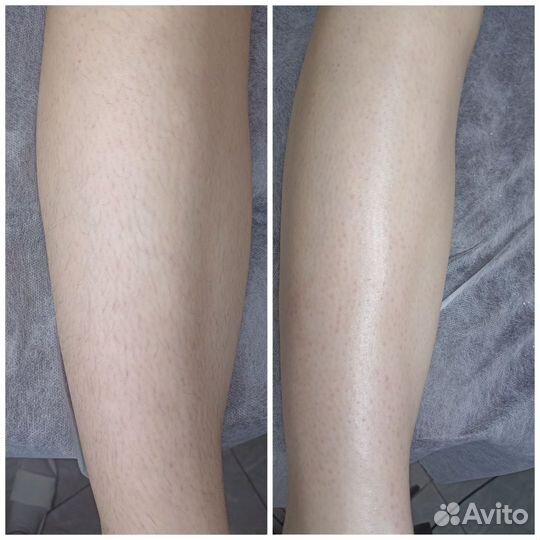 Мастер по депиляции