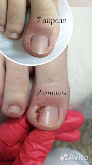 Услуги профессионального подолога