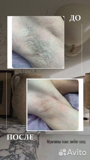 Депиляция/ шугаринг