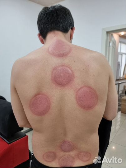 Вакуумный массаж